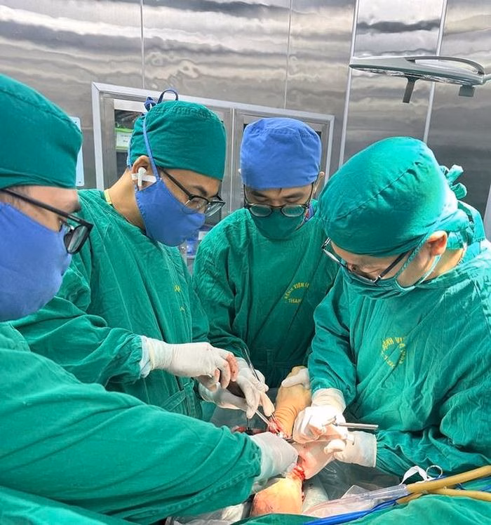 Các bác sĩ khoa Chỉnh hình - Bỏng phối hợp nhịp nhàng trong ca phẫu thuật nối chi thể phức tạp cho bệnh nhân L.D.T.